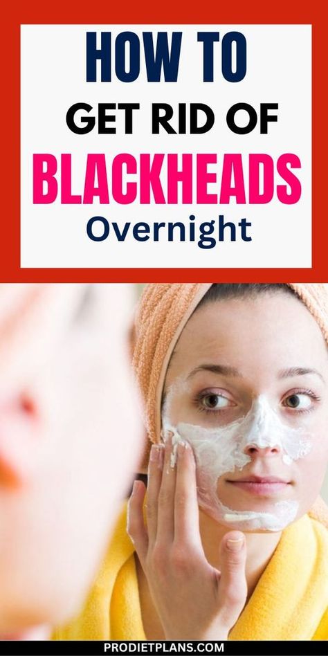 How to Get Rid of Blackheads