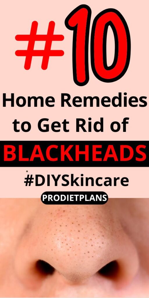 How to Get Rid of Blackheads: 10 Home Remedies That Work Fast